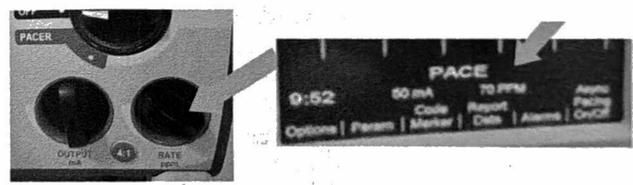 The Rate dial and the screen reading 70 PPM.
